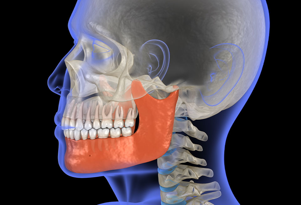 jaw xray